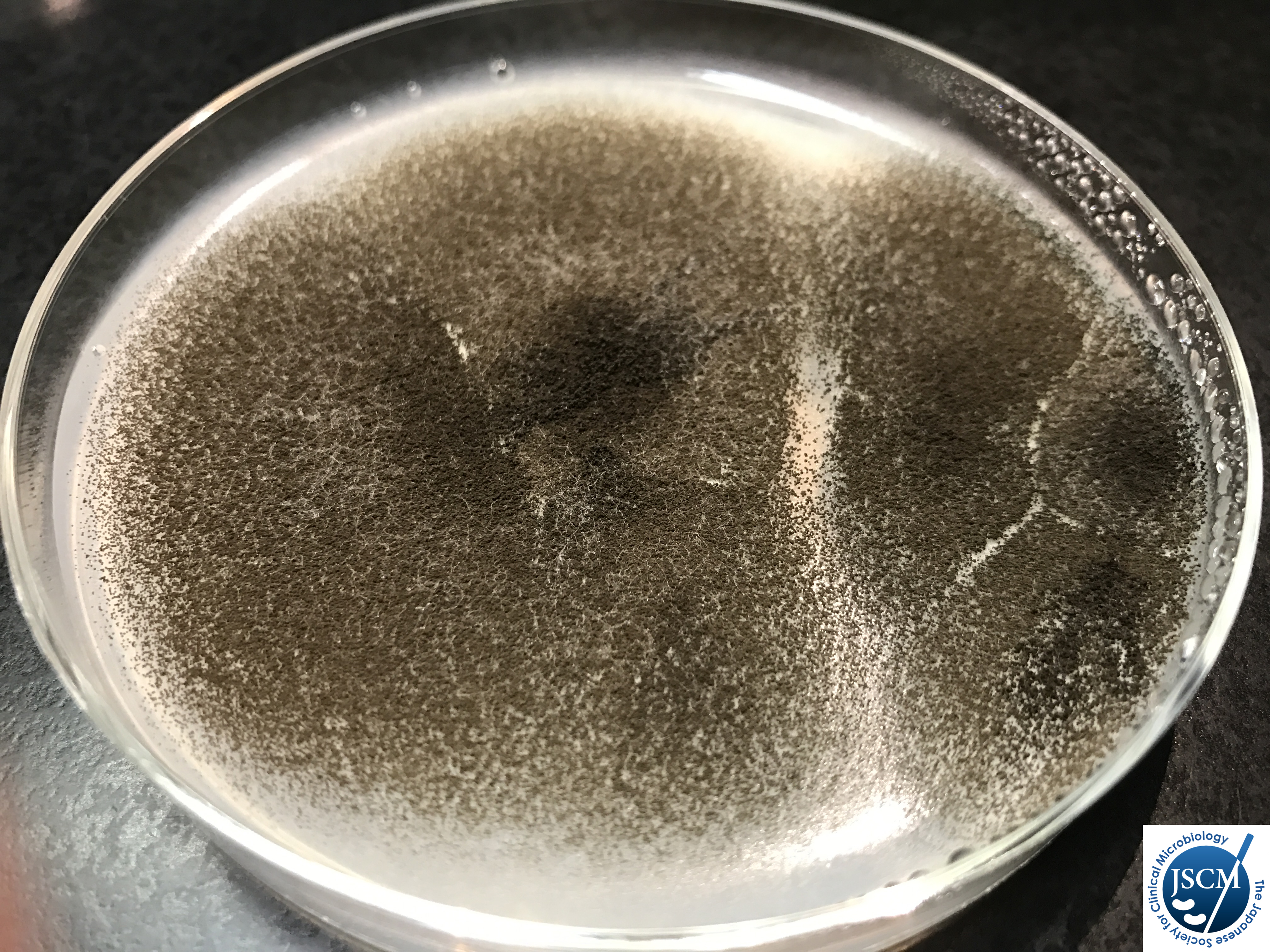 o517 峻厳なるアストラス 臨床微生物学アトラス｜日本臨床微生物学会