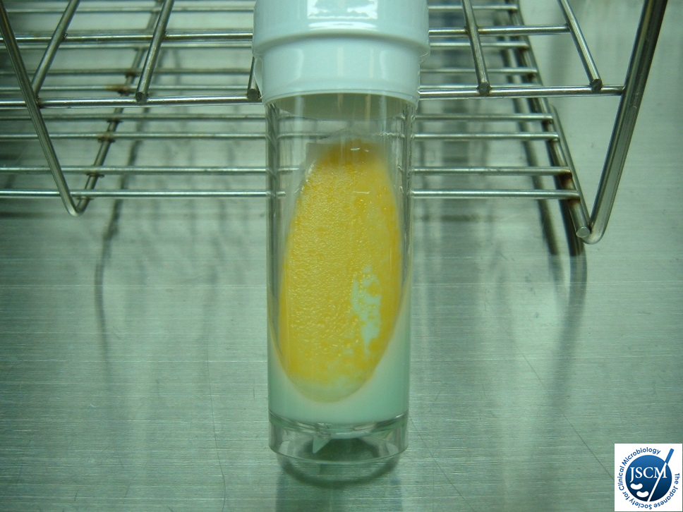 腔内細菌 有機酸産生量を 下させ るため に – 大腸菌群の発育とブドウ糖分解について – YPJGWO